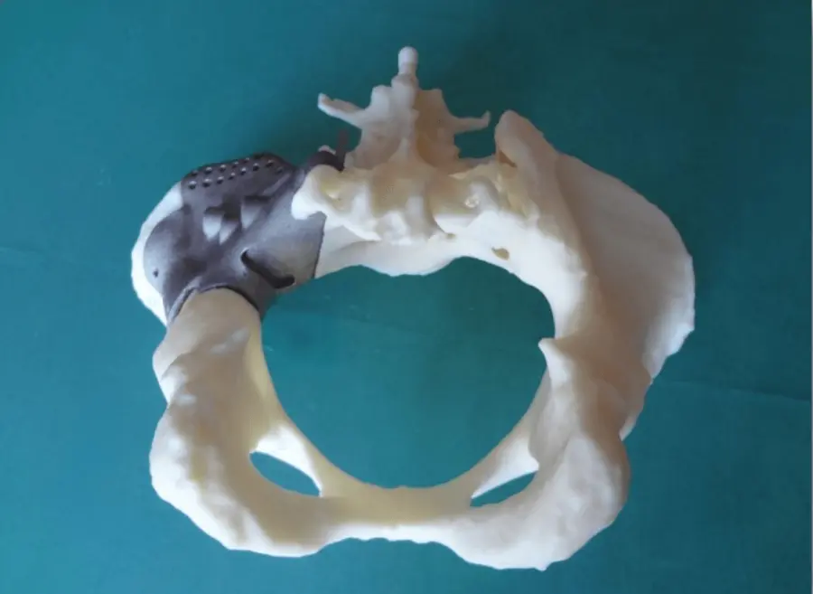 Roma, prime ossa stampate in 3D