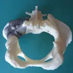 Roma, prime ossa stampate in 3D